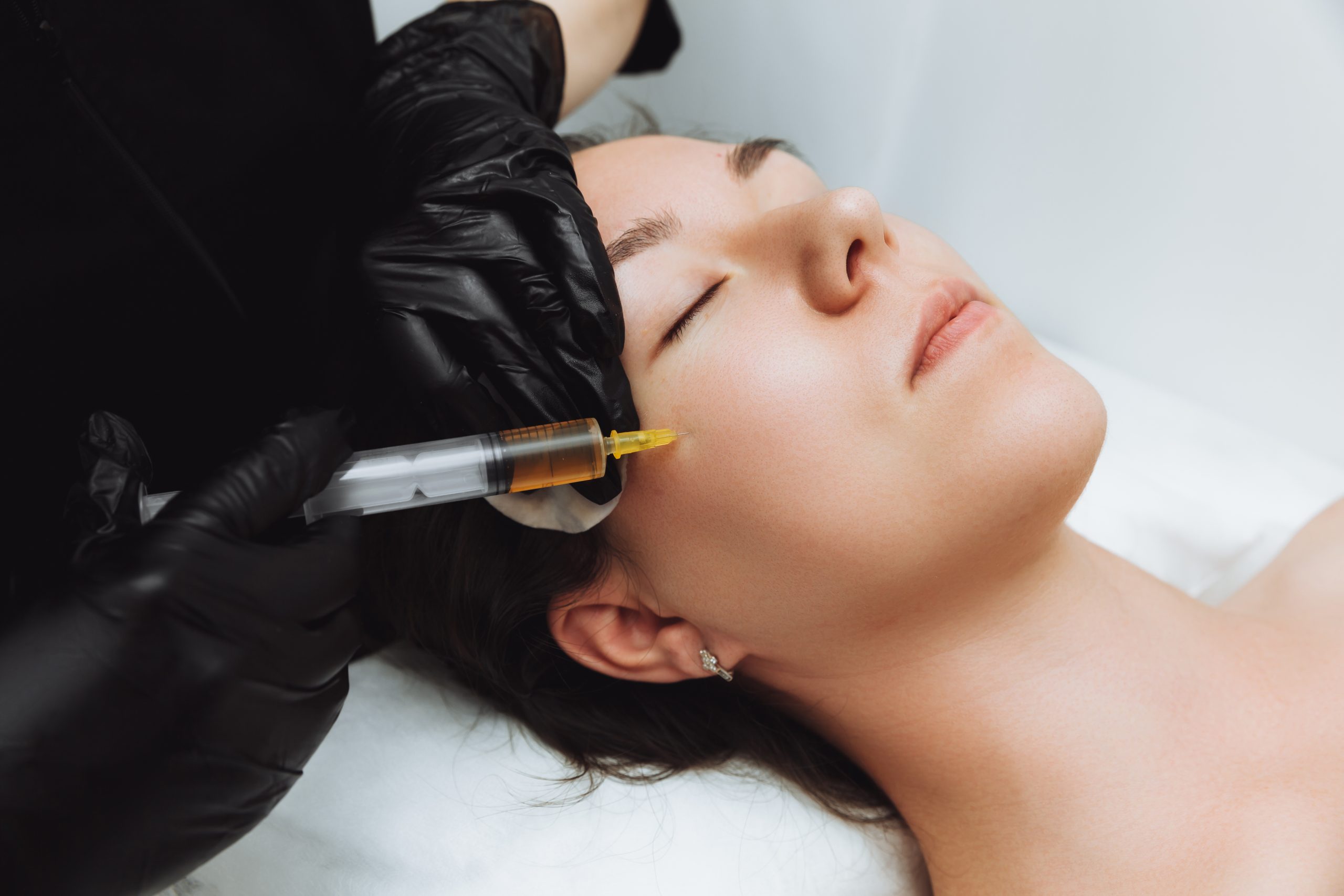 10 Steps to Take Before and After Your First PRP Facial